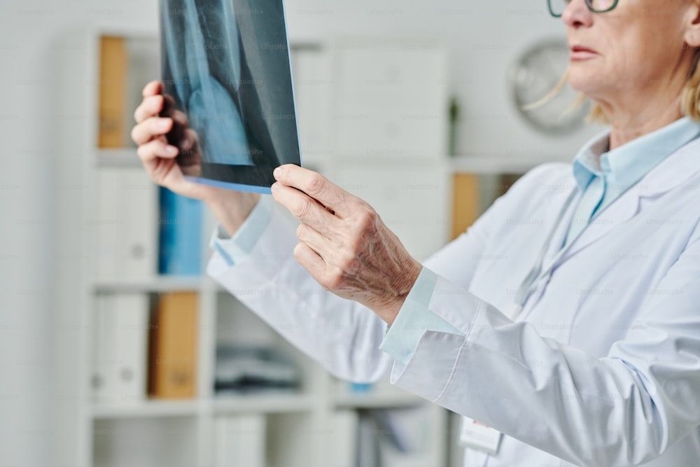 Hands of mature radiologist in whitecoat trying to establish diagnosis to patient while looking at x-ray image of lungs in clinics