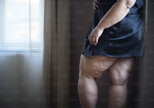 Uma mulher gorda com celulite nas pernas, cortada.
