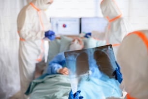 Equipe médica com raio-x cuidando de paciente infectado no hospital, conceito de coronavírus.