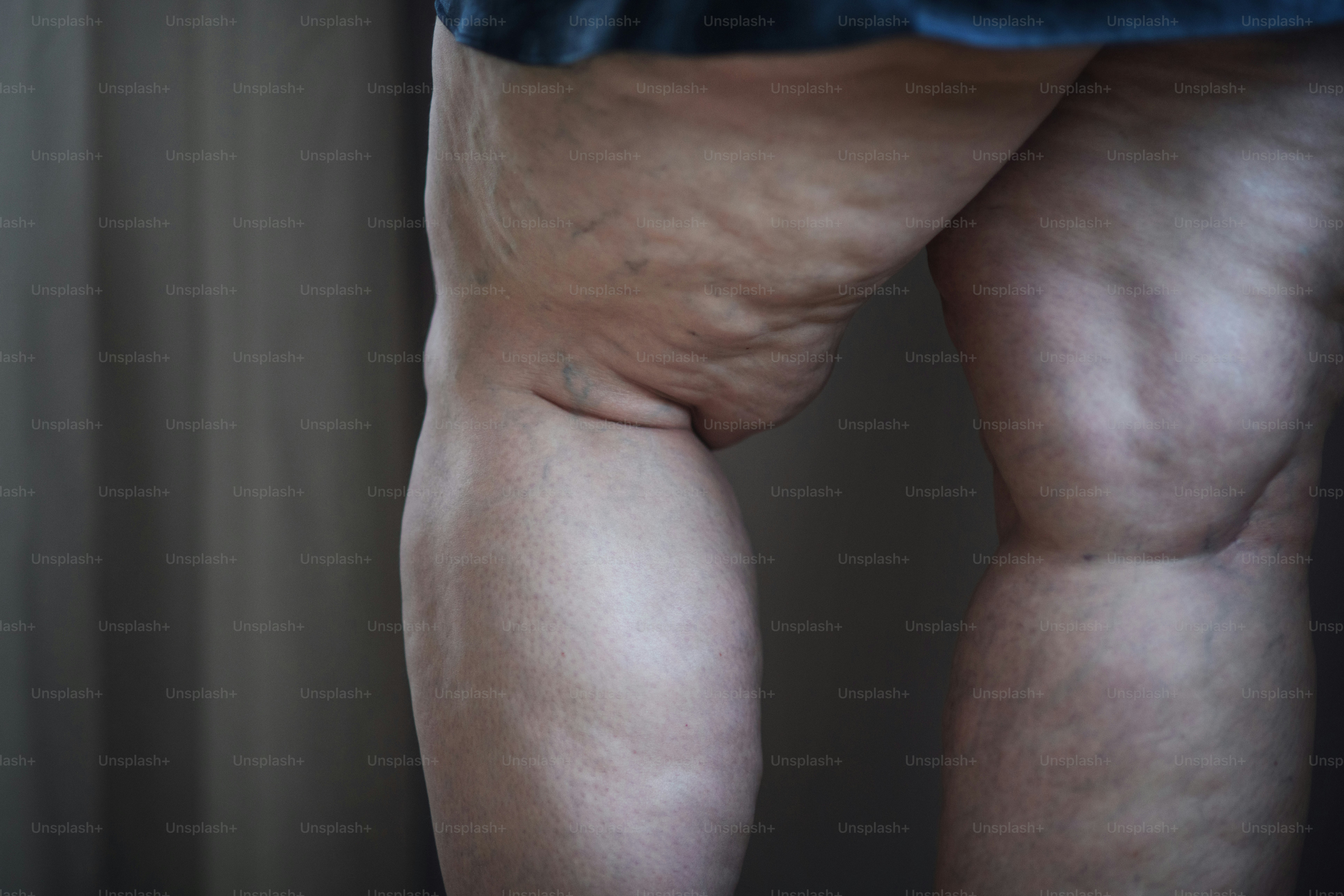 A fat woman with cellulite on her legs, cut out.