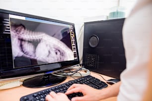 Female Veterinary Surgeon Examining X Ray of a dog. Vet looking at animals radiography. Unrecognizable veterinarian in white uniform at veterinary clinic working.