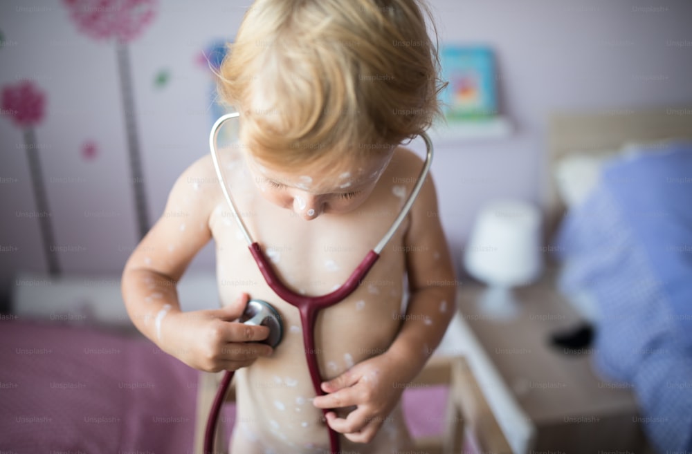 Little two year old girl at home sick with chickenpox, white antiseptic cream applied to the rash. Playing with stethoscope, listening to her heartbeat .