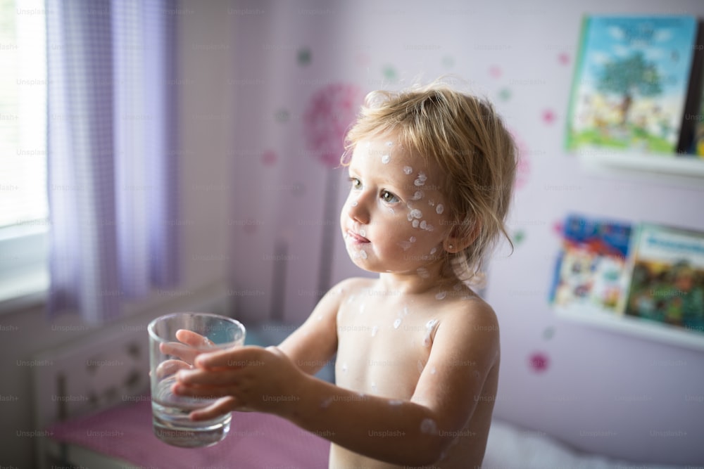 Menina de dois anos de idade em casa doente com varicela, creme antisséptico branco aplicado à erupção cutânea. Segurando um copo, bebendo água.