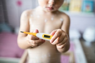 Menina irreconhecível de dois anos de idade em casa doente com varicela, creme antisséptico branco aplicado à erupção cutânea, segurando termômetro, mostrando temperatura. De perto.