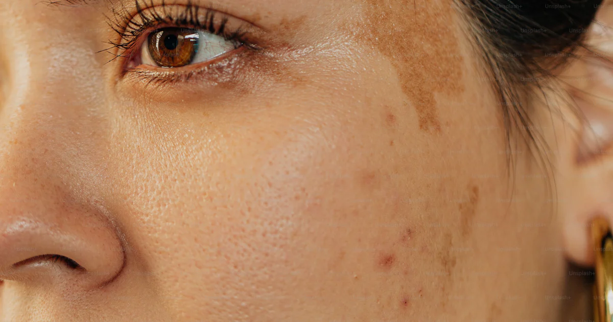 Frecking A close up of a woman with freckles on her face photo – Portrait Image ...