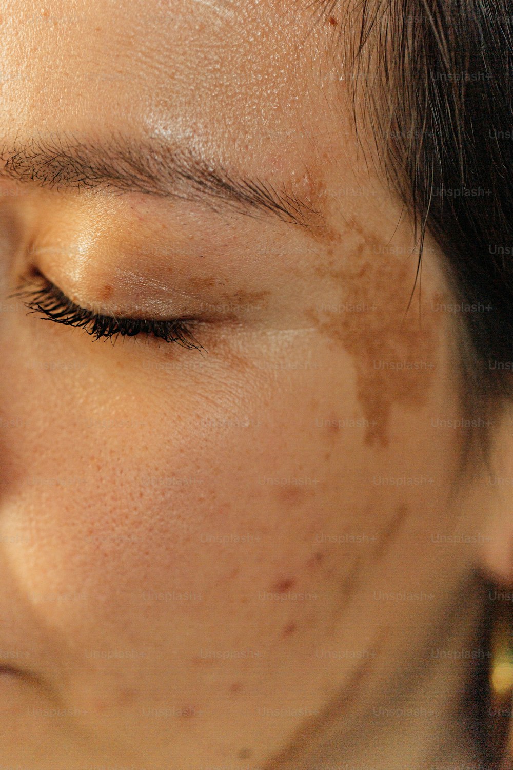Eine Nahaufnahme einer Frau mit Sommersprossen im Gesicht