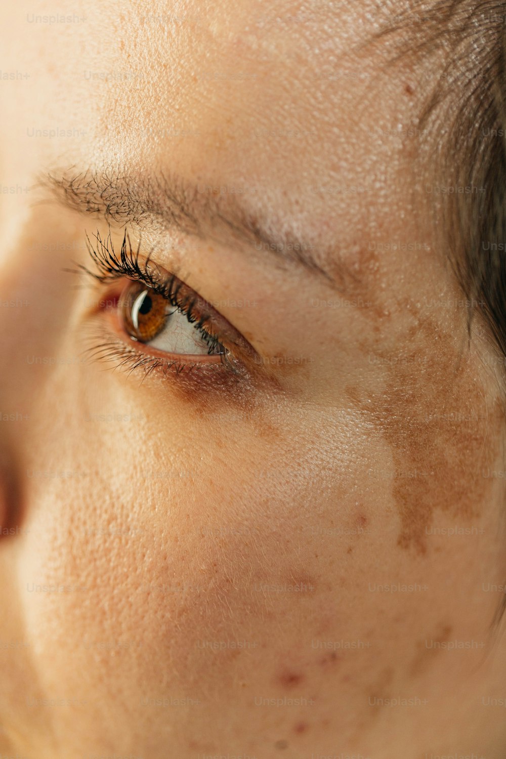 a close up of a person with freckles on their eyes