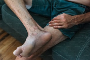 a man sitting on a couch holding his leg