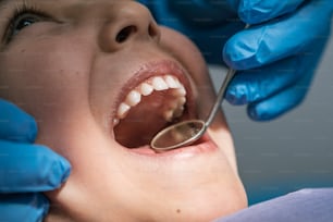Close up of dentist during a dental intervention