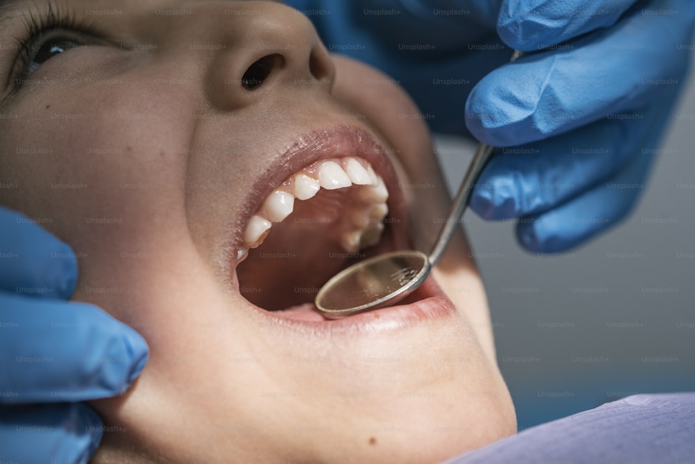 Close up of dentist during a dental intervention