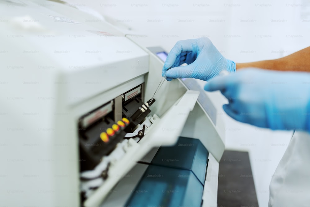 Close up do assistente de laboratório com luvas de borracha estéril soltando amostra de urina na máquina.