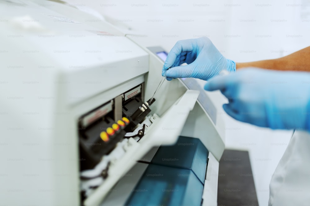 Close up of lab assistant with sterile rubber gloves dropping sample of urine into machine.