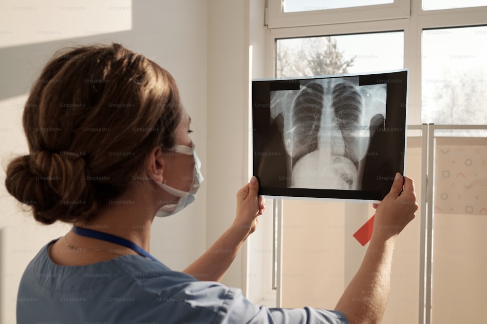 Giovane medico femminile contemporaneo che tiene l'immagine a raggi X dei polmoni del paziente davanti a sé mentre lo guarda attentamente