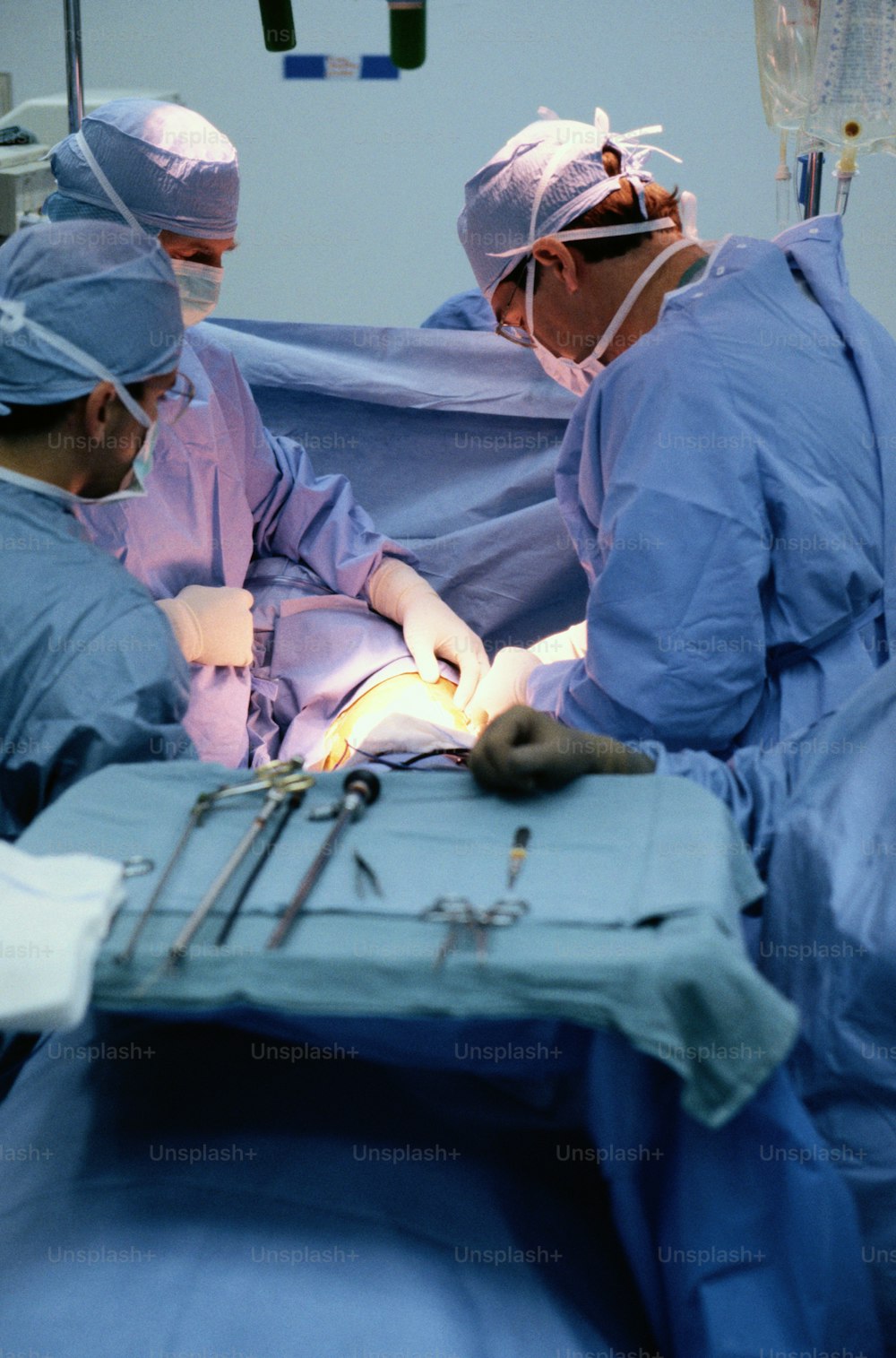 a group of doctors performing surgery in a hospital