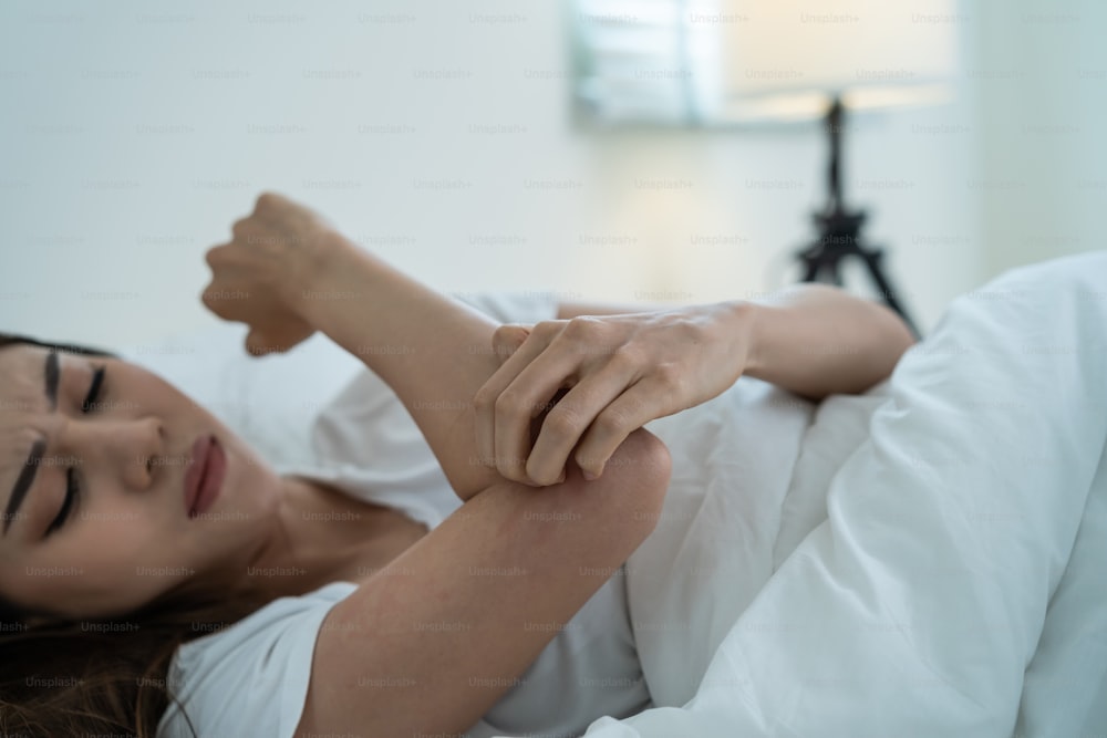Asiatische junge Frau kratzt Hand fühlen leiden an einer Allergie während des Schlafes. Schönes attraktives Mädchen liegt auf dem Bett im Schlafzimmer und leidet an juckender Armhaut allergische Reaktion auf Insektenstiche, Dermatitis.