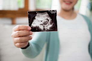 La femme enceinte montre l’image échographique à la maison, se concentre sur l’image échographique