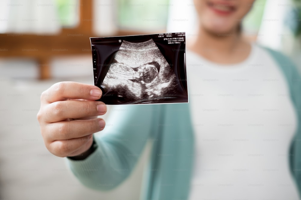 Pregnant woman show ultrasound image at home, focus on ultrasound image