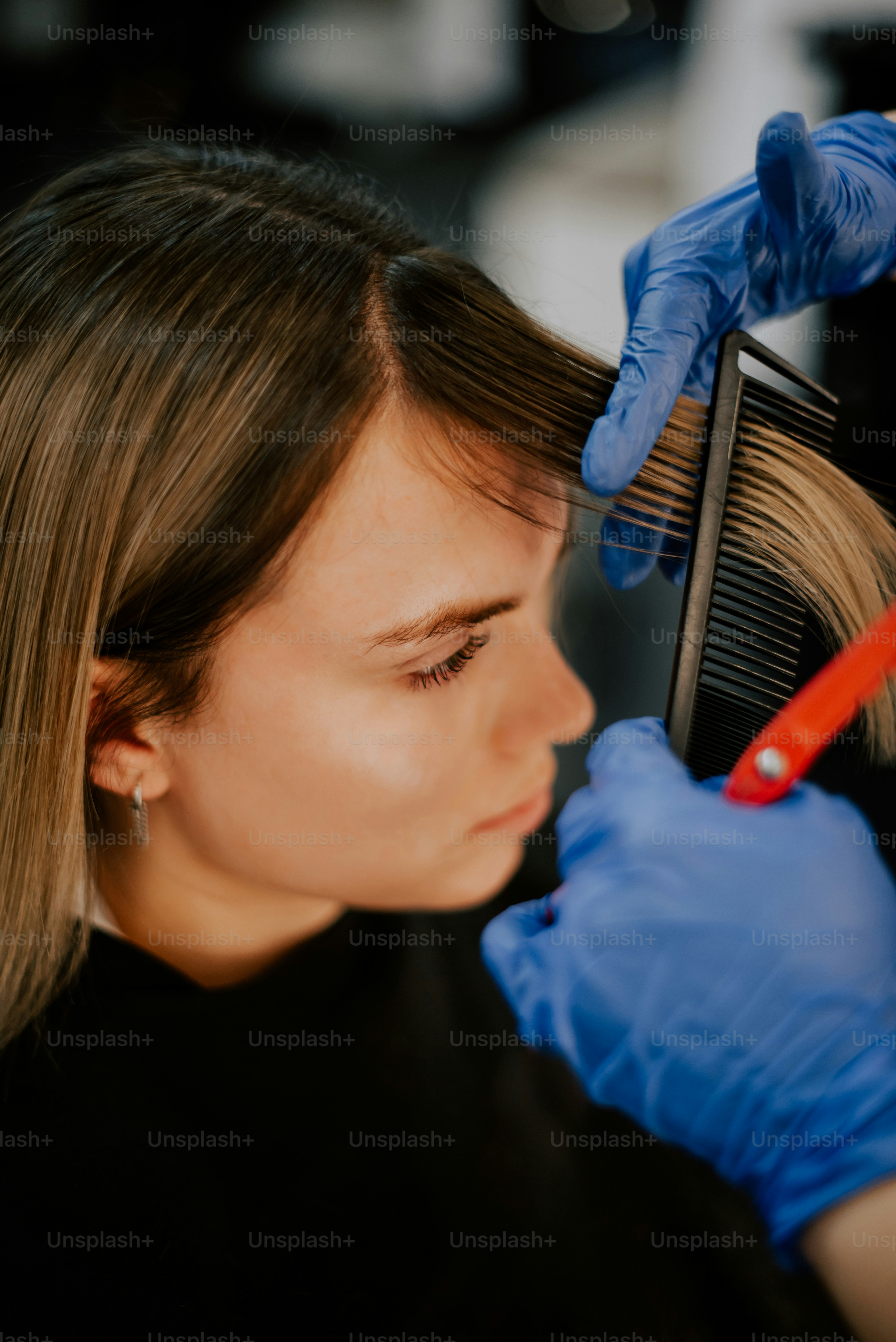 여성모발이식후기