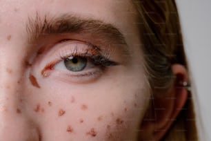 Eine Nahaufnahme einer Person mit braunen Flecken im Gesicht