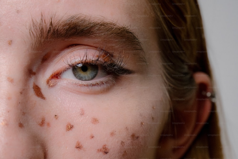 um close up de uma pessoa com manchas marrons no rosto