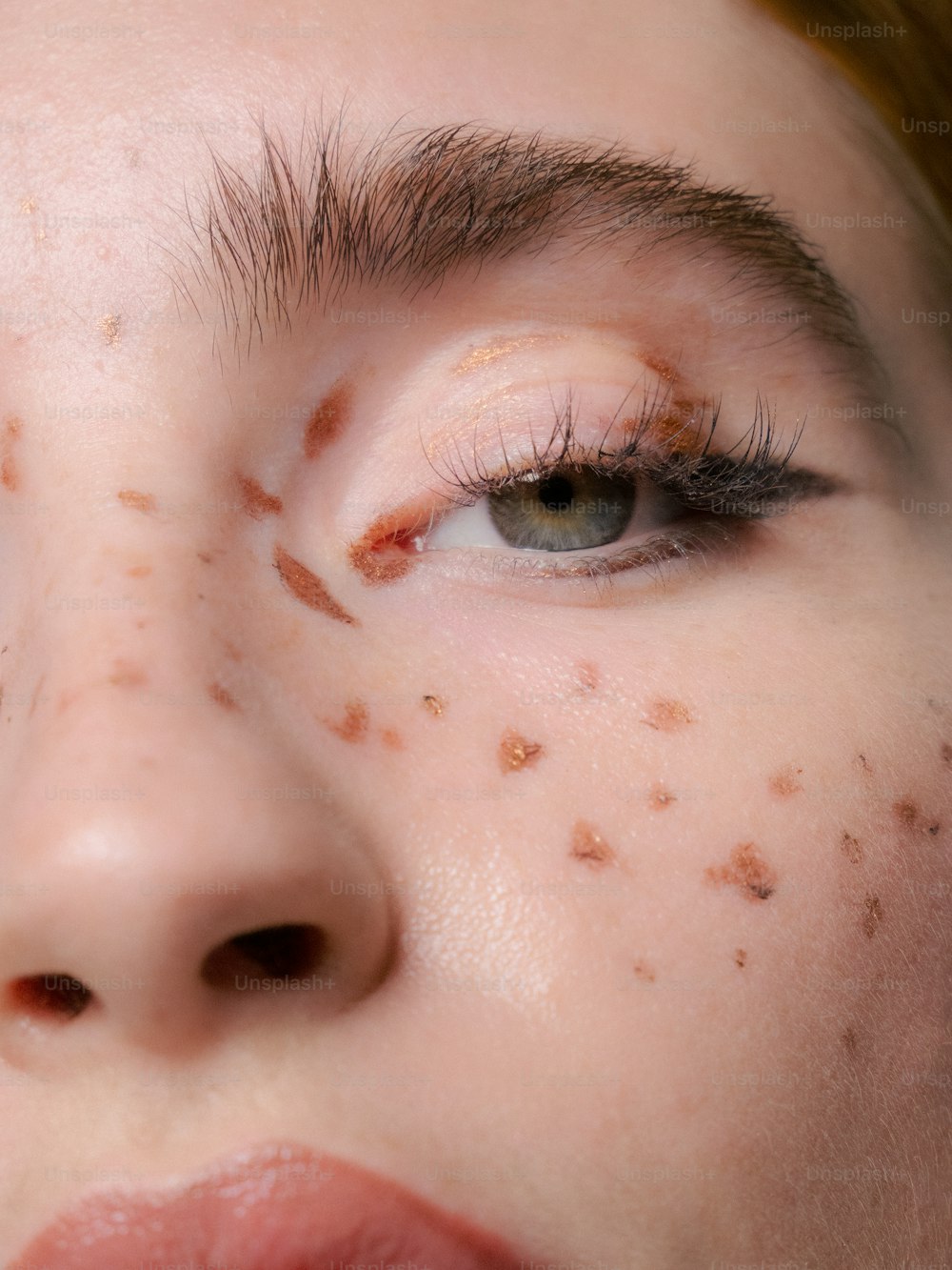 um close up de uma mulher com acne no rosto
