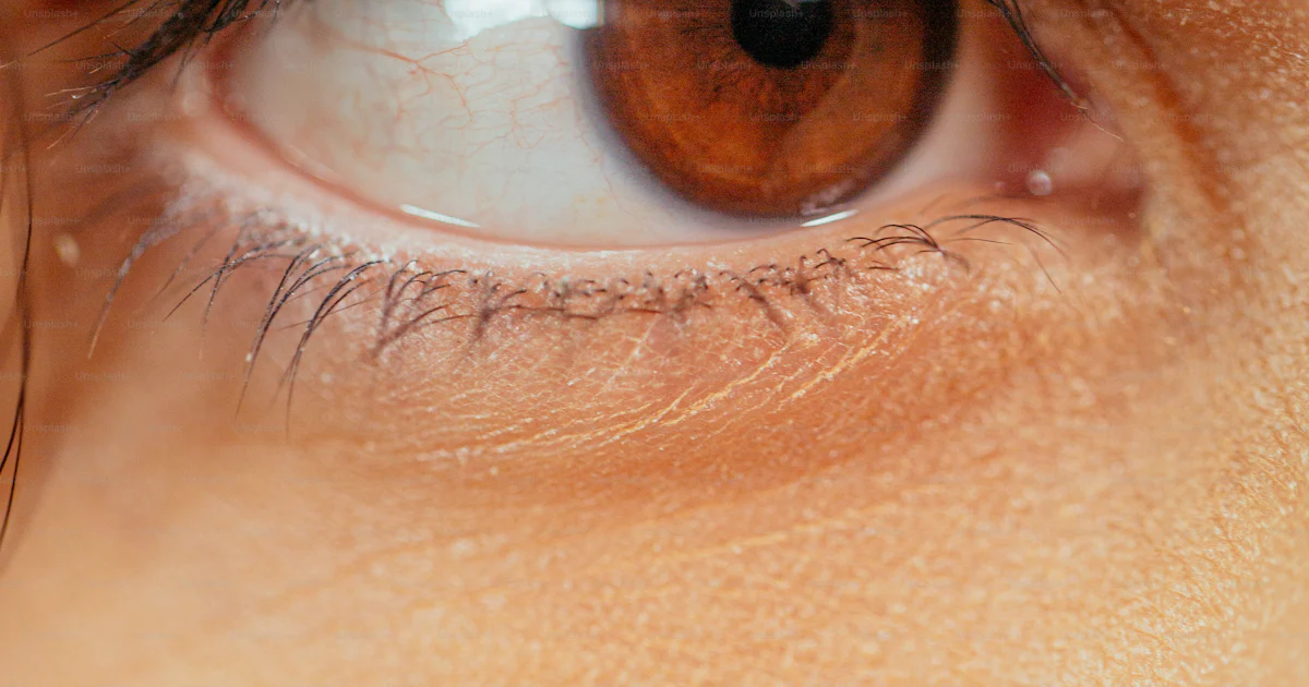 A Close Up Of A Person s Brown Eye Photo Dermatology Image On Unsplash a-close-up-of-a-person-s-brown-eye-photo-dermatology-image-on-unsplash