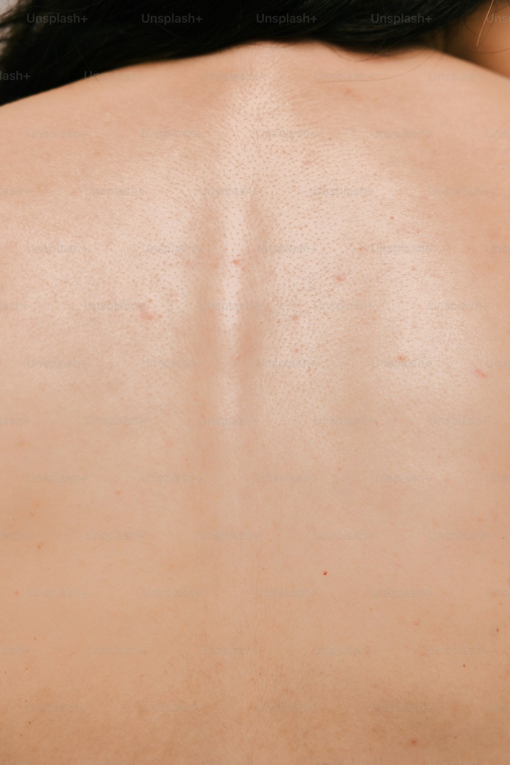 La parte posteriore della schiena di una donna con un sacco di lentiggini