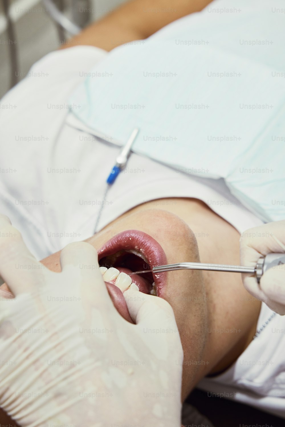 a man getting his teeth checked by a dentist