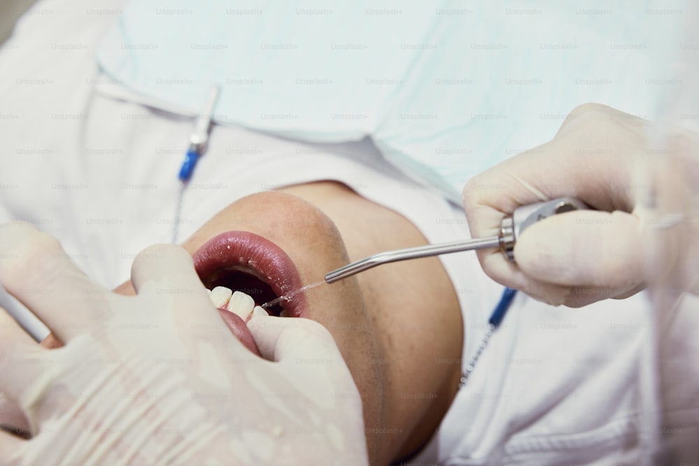 Un hombre que se hace revisar los dientes por un dentista