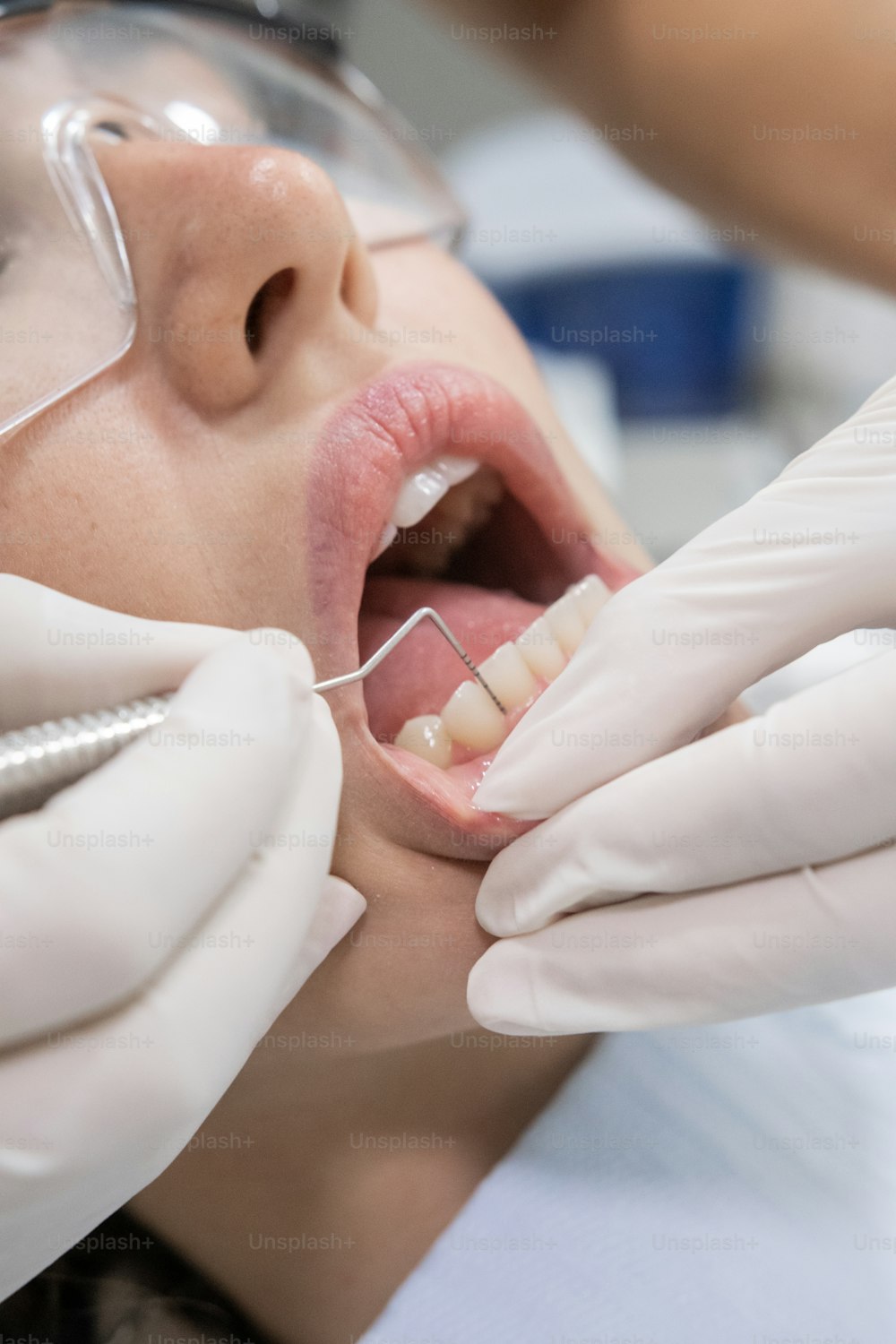 a woman getting her teeth checked by a dentist