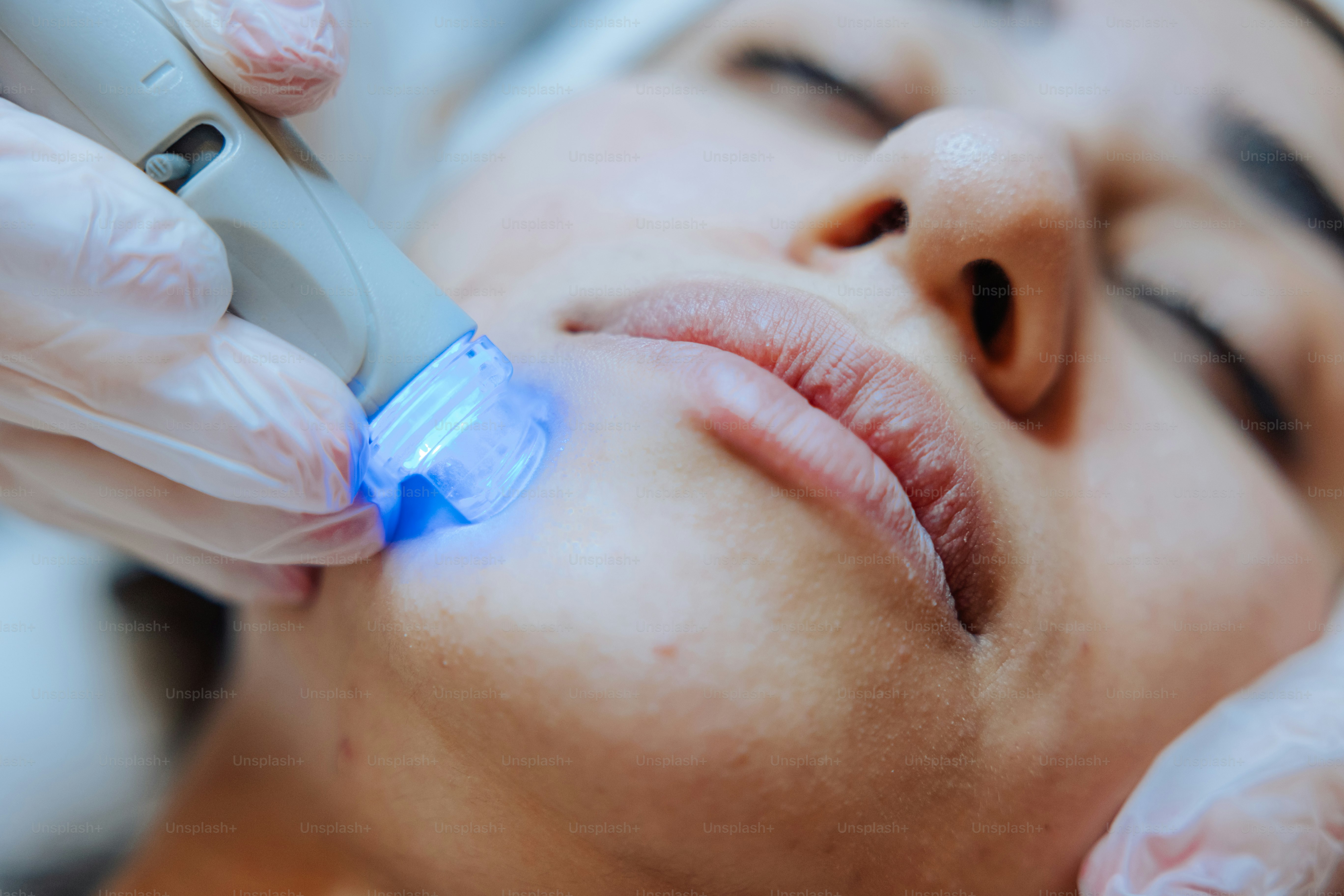 a woman getting a facial peel from a doctor