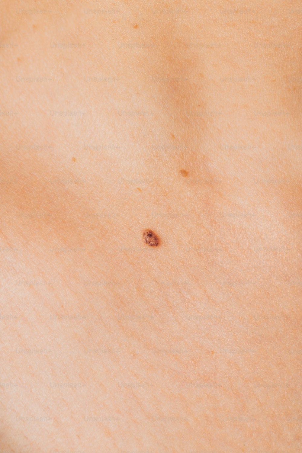 um close up do estômago de uma pessoa com um ponto sobre ele