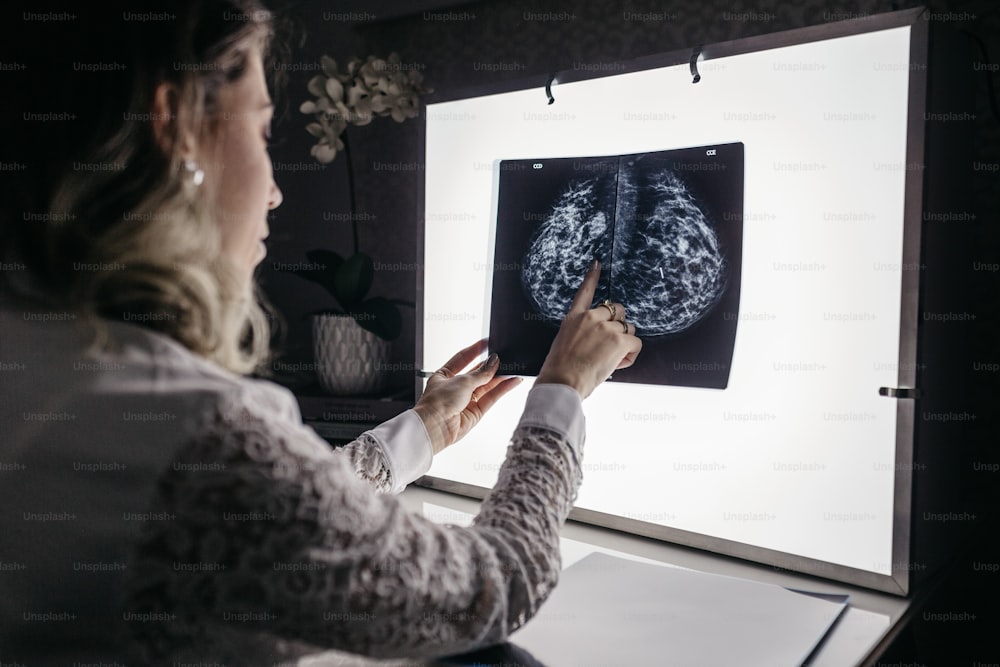 a woman pointing at a picture of a lung
