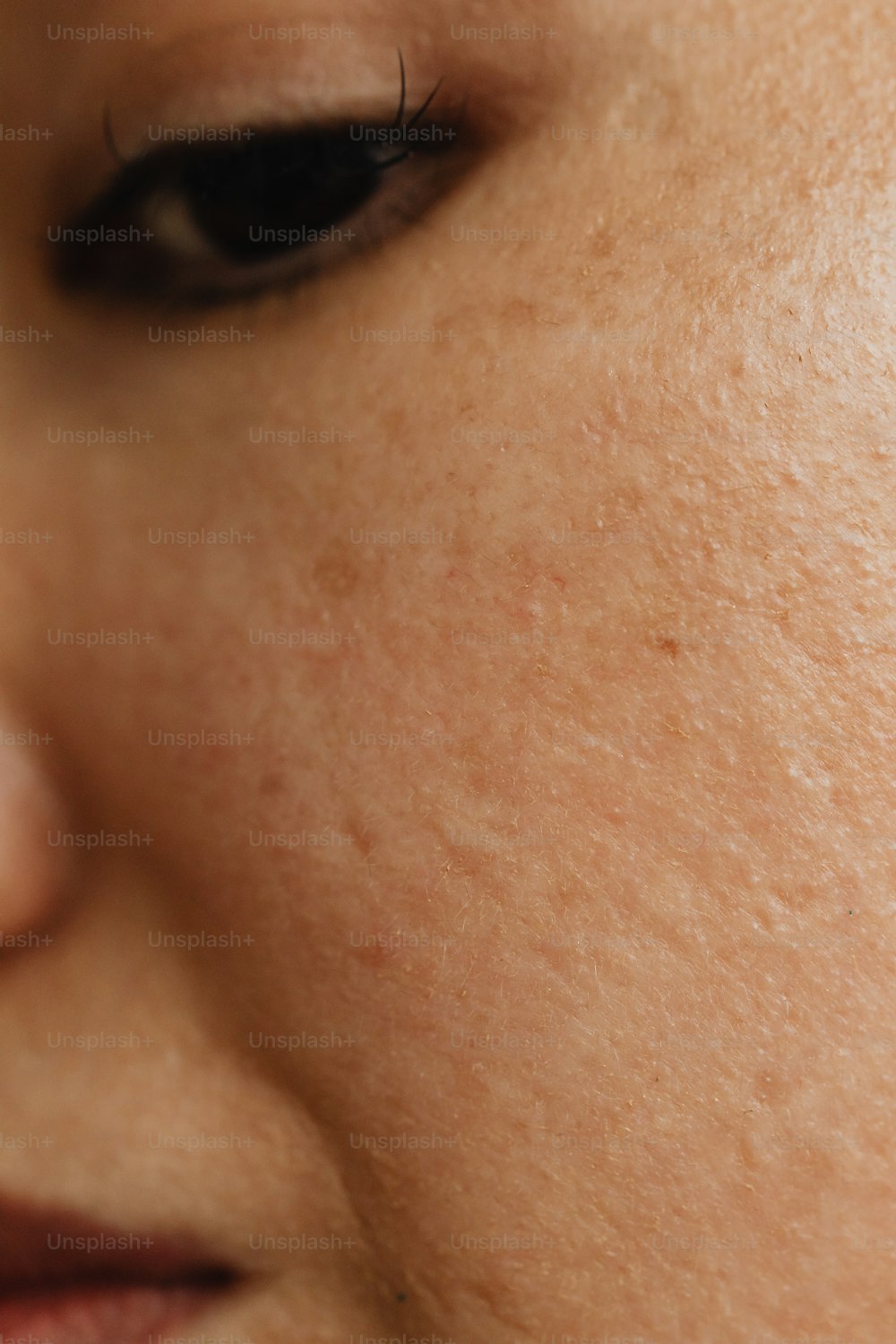 a close up of a woman's face with freckles