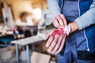 Un operaio nel laboratorio di falegnameria, con una mano ferita. Infortunio sul lavoro.