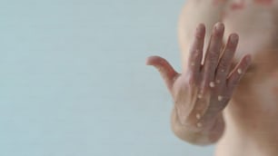 흰 배경에 원숭이두창 또는 기타 바이러스 감염으로 인해 물집이 생기는 발진의 영향을 받는 남성의 손