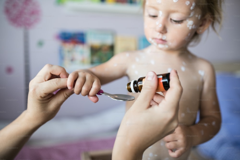 Kleines zweijähriges Mädchen zu Hause, das an Windpocken erkrankt ist, weiße antiseptische Creme aufgetragen. Unkenntliche Mutter, die ihre Medizin auf Löffel gibt.