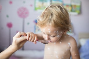 自宅で水痘にかかっている小さな2歳の女の子、白い消毒クリームを塗った。認識できない母親がスプーンで薬を与え、それを食べます。
