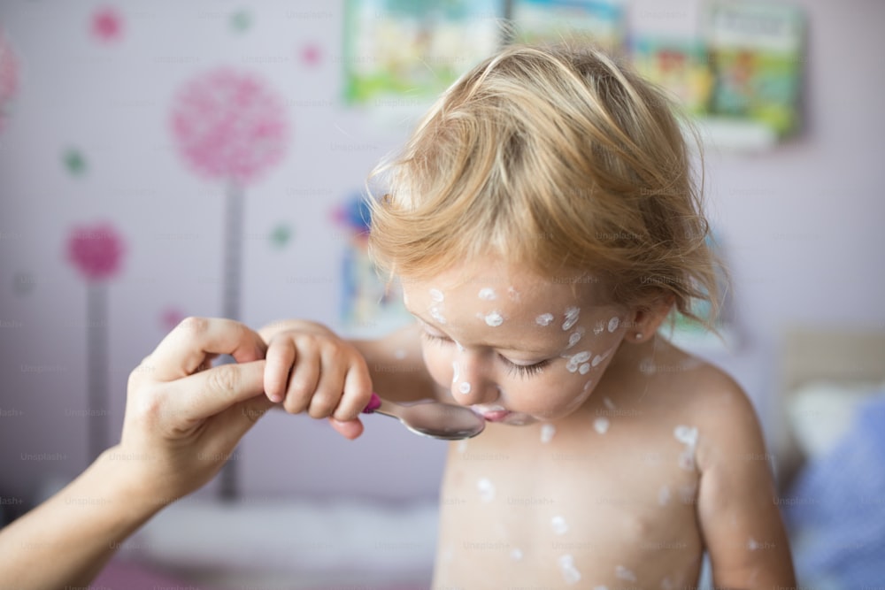 Menina de dois anos de idade em casa doente com varicela, creme antisséptico branco aplicado. Mãe irreconhecível dando seu remédio na colher, comendo-o.