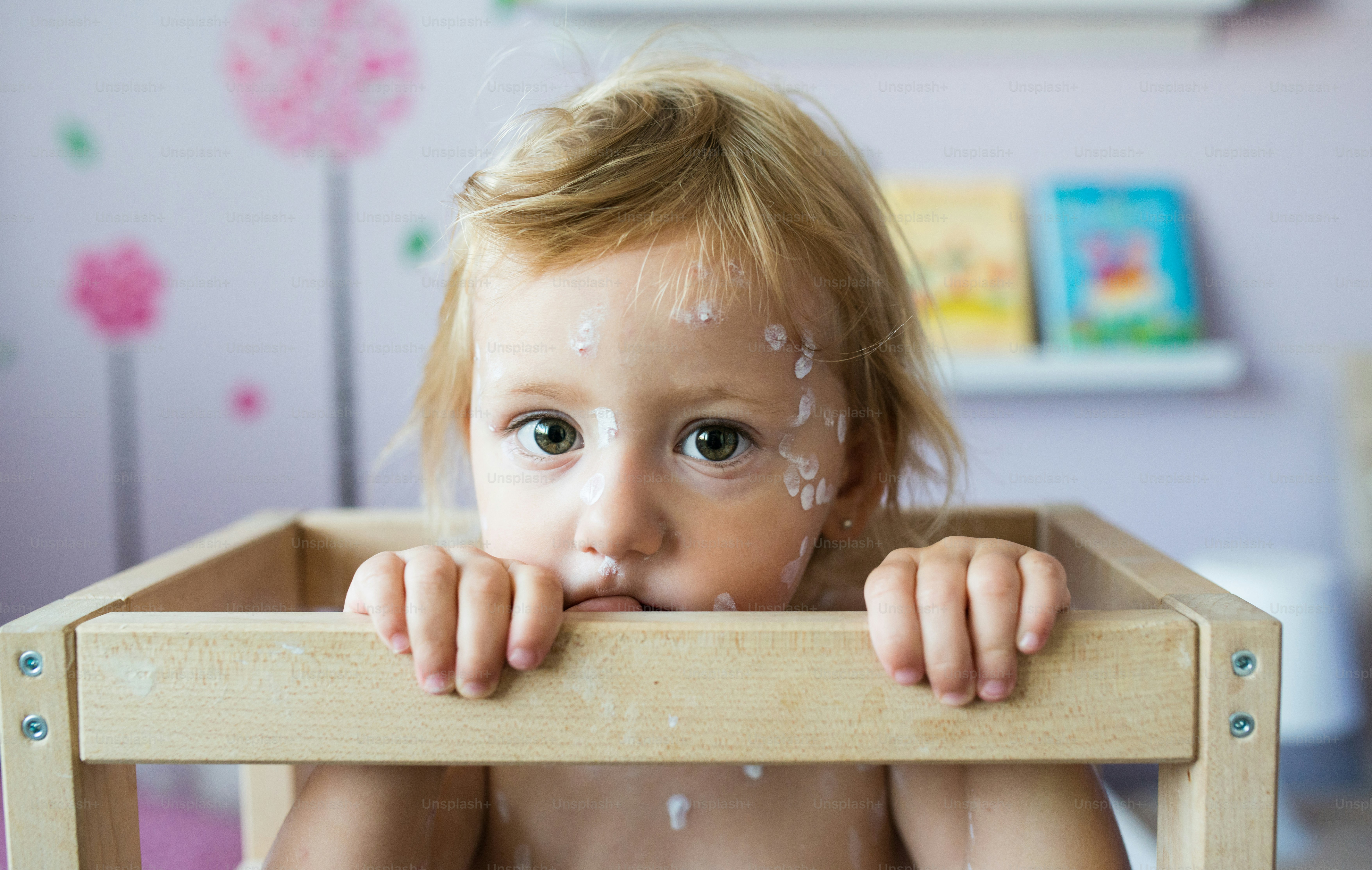 Little two year old girl at home sick with chickenpox, sitting in wooden chair. White antiseptic cream applied to the rash.
