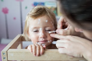Piccola bambina di due anni a casa malata di varicella, crema antisettica bianca applicata da sua madre all'eruzione cutanea