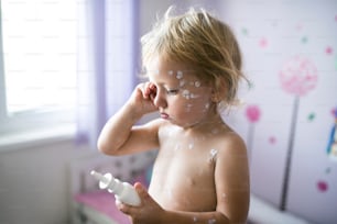 Niña de dos años en casa enferma de varicela, crema antiséptica blanca aplicada a la erupción