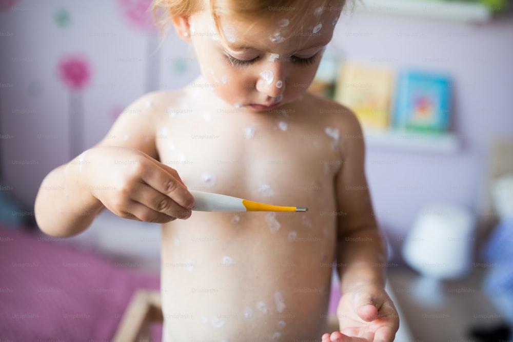 Bella bambina di due anni a casa malata di varicella, crema antisettica bianca applicata all'eruzione cutanea. Tenendo il termometro, guardando la temperatura.