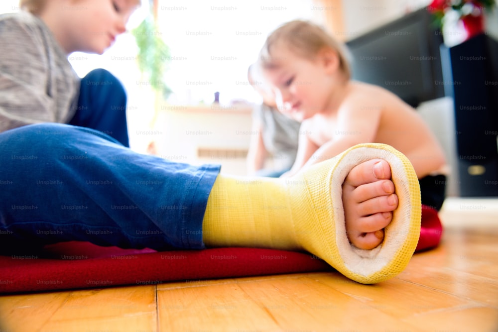 Primo piano della gamba rotta nel calco di un ragazzino che gioca con il suo fratellino seduto sul pavimento di legno. Divertimento diurno per bambini. Felice di essere a casa.