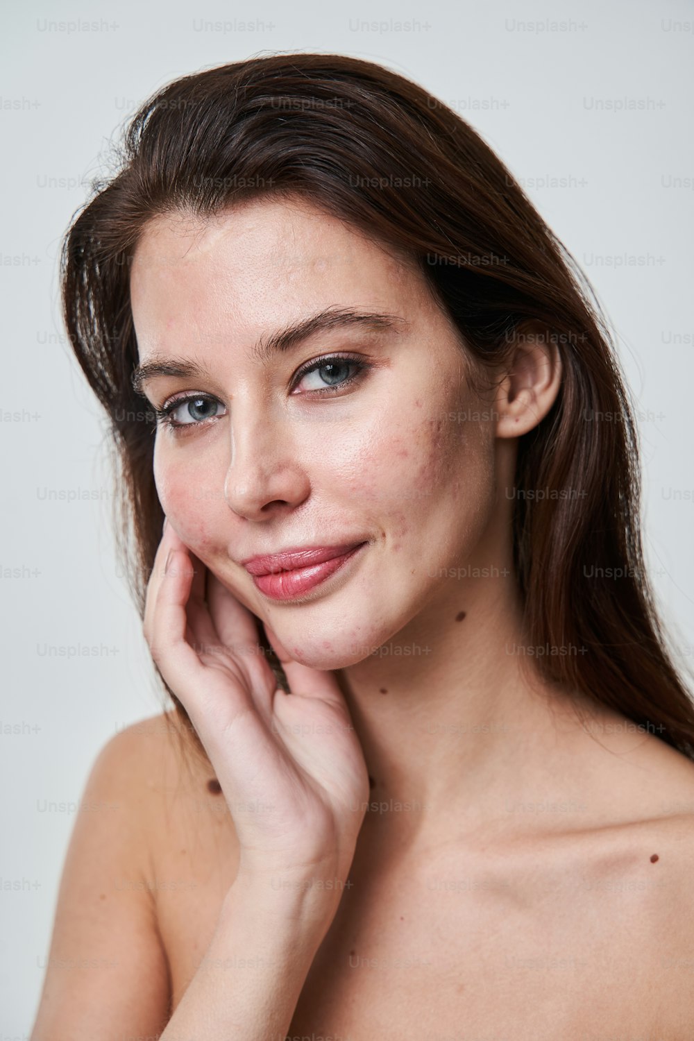 Beleza natural. Retrato de menina caucasiana calma com manchas pós-acne e imperfeições da pele posando sobre o fundo cinza do estúdio enquanto olha para a câmera
