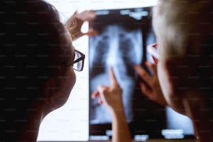 Vista trasera de cerca de dos enfermeras profesionales con anteojos que muestran con los dedos la radiografía de un paciente.