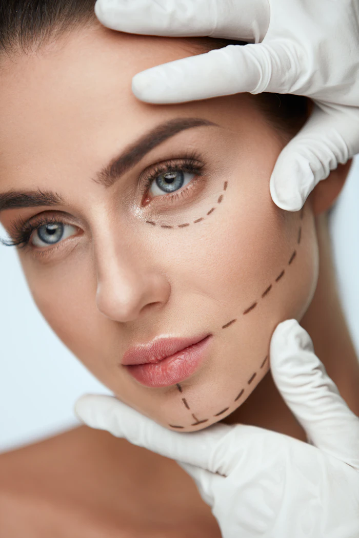 Cirugía facial