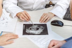 Female gynecologist is sitting at table and presenting Uzi photo of child