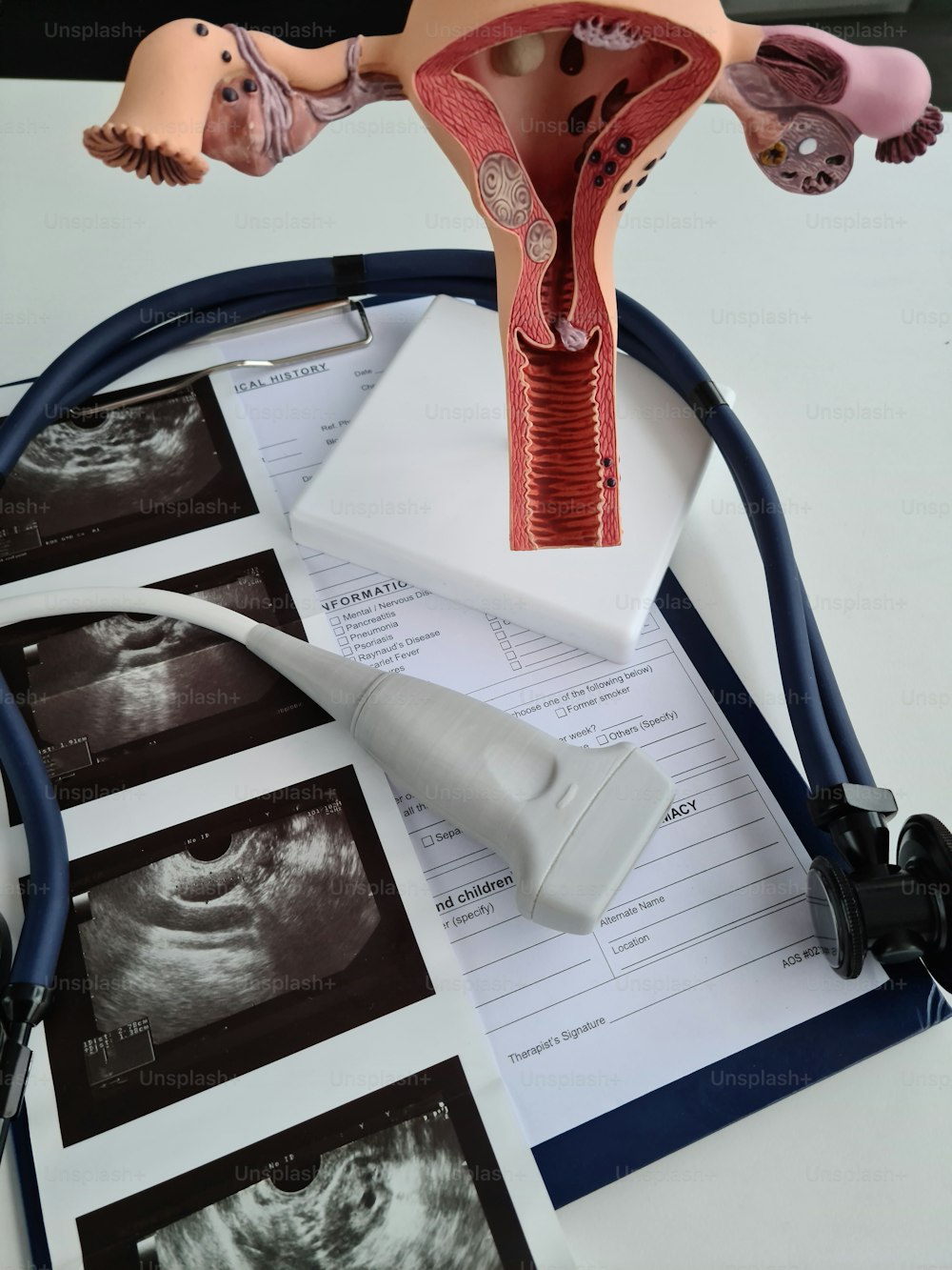 Ultraschall der Gebärmutter und Erkrankungen des weiblichen Fortpflanzungssystems. Gynäkologische Erkrankungen der Frau und medizinisches Diagnostikkonzept