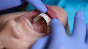 베니어판으로 환자의 구강을 검사하는 의사 치과 의사. 복합재 및 지르코늄 베니어 개념 설치